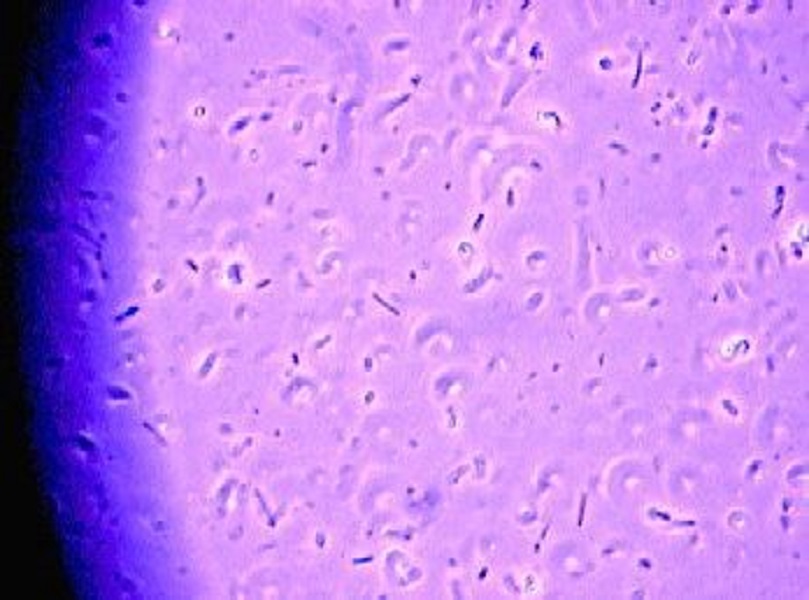 CHEMICALBUKASHI1